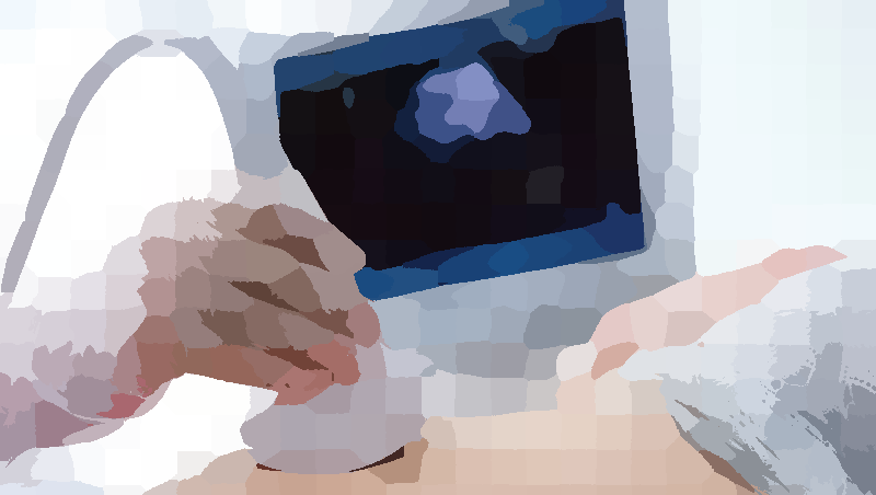 Hand mit Sonde