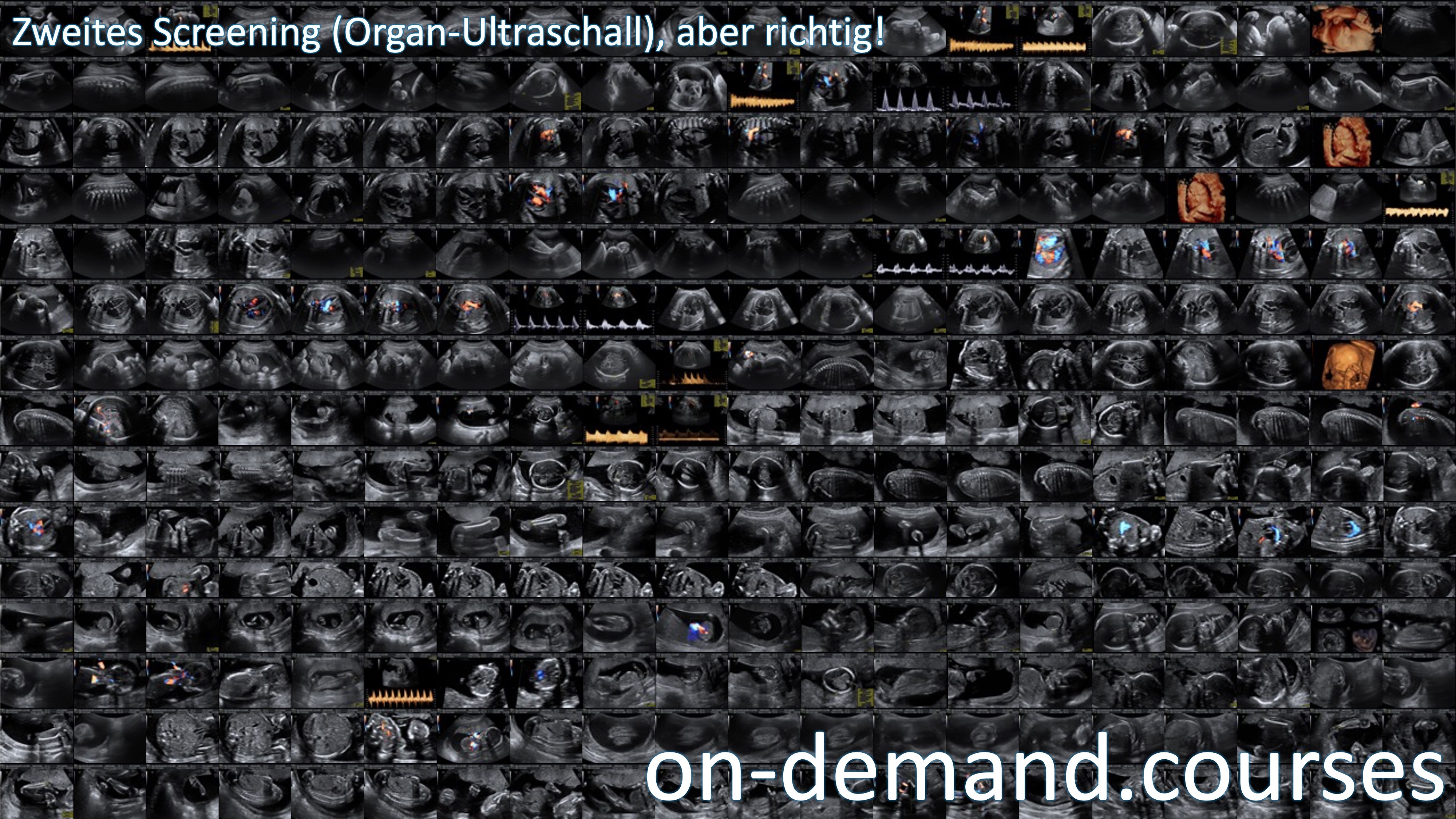 Zweites Screening (Organ-Ultraschall), aber richtig!